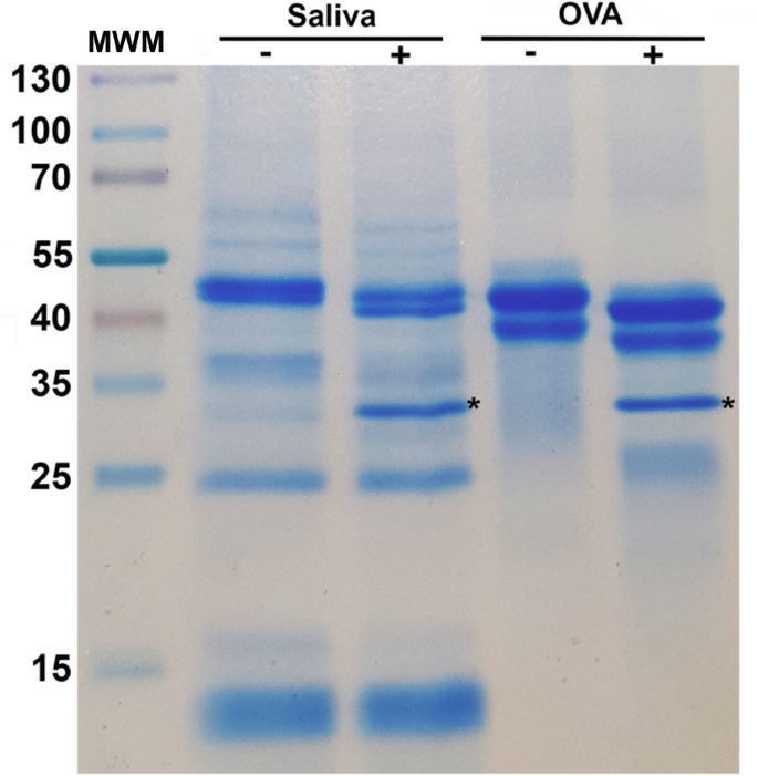 Insights Into The Salivary N Glycome Of Lutzomyia Longipalpis Vector Of Visceral Leishmaniasis Scientific Reports