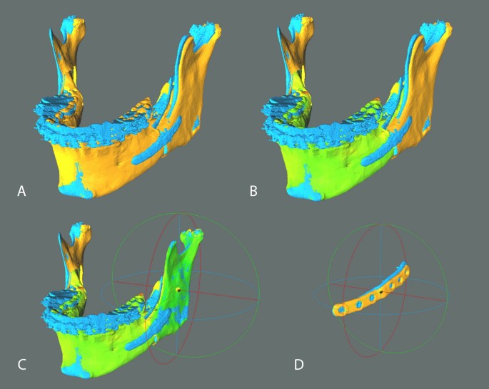 figure4