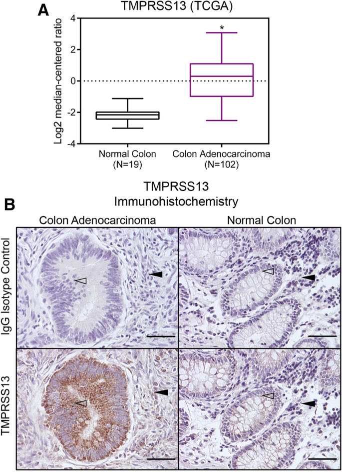Tmprss13 Promotes Cell Survival Invasion And Resistance To Drug Induced Apoptosis In Colorectal Cancer Scientific Reports