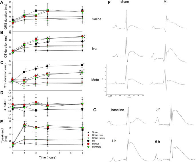 Ivabradine Is As Effective As Metoprolol In The Prevention Of Ventricular Arrhythmias In Acute Non Reperfused Myocardial Infarction In The Rat Scientific Reports