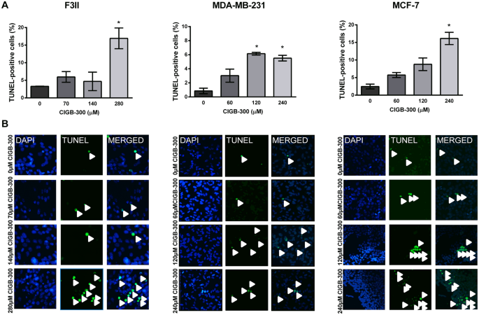 Preclinical Efficacy Of Cigb 300 An Anti Ck2 Peptide On Breast Cancer Metastasic Colonization Scientific Reports Preclinical Efficacy Of Cigb 300 An Anti Ck2 Peptide On Breast Cancer Metastasic Colonization Scientific Reports