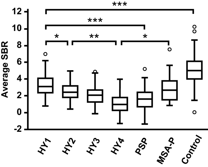 Laterality of specific binding ratios on DAT-SPECT for differential  diagnosis of degenerative parkinsonian syndromes | Scientific Reports