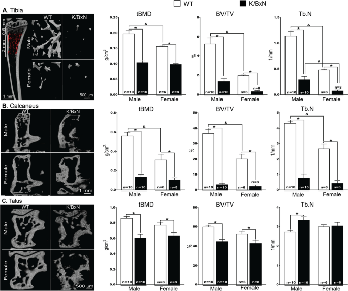 The Neuropathic Phenotype Of The K Bxn Transgenic Mouse With Spontaneous Arthritis Pain Nerve Sprouting And Joint Remodeling Scientific Reports