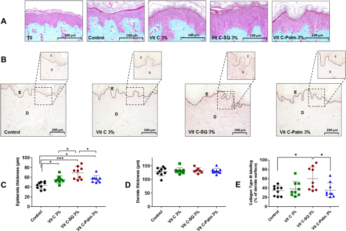 Vitamin C–squalene bioconjugate promotes epidermal thickening and collagen  production in human skin | Scientific Reports