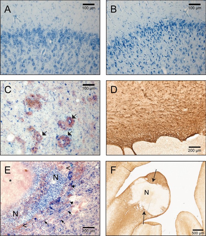 Radionecrosis And Cellular Changes In Small Volume Stereotactic Brain Radiosurgery In A Porcine Model Scientific Reports