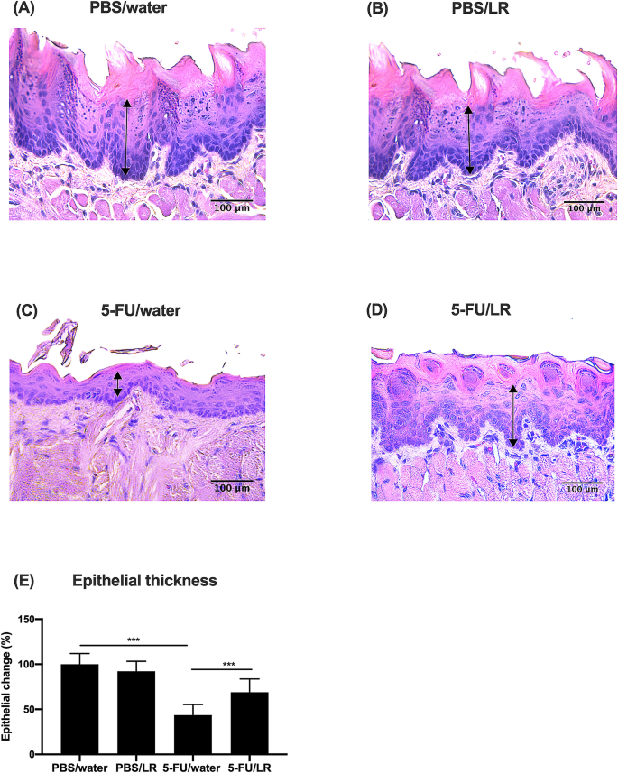 Lactobacillus Reuteri Dsm And Atcc Pta 52 Ameliorates Chemotherapy Induced Oral Mucositis Scientific Reports