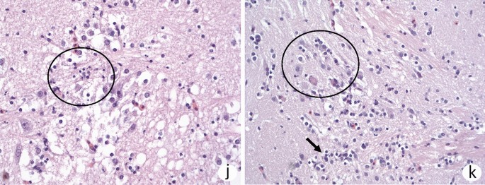 Tilapia lake virus downplays innate immune responses during early stage of  infection in Nile tilapia (Oreochromis niloticus) | Scientific Reports