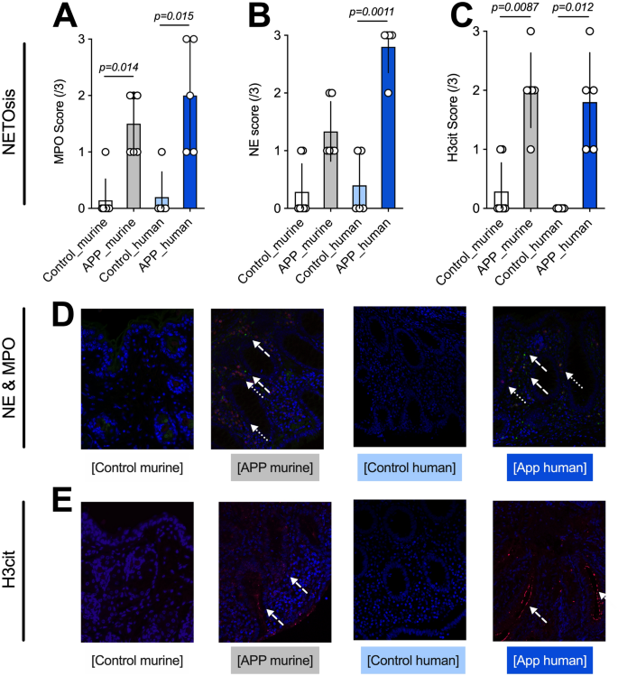 Markers of neutrophil activation and extracellular traps formation are  predictive of appendicitis in mice and humans: a pilot study | Scientific  Reports