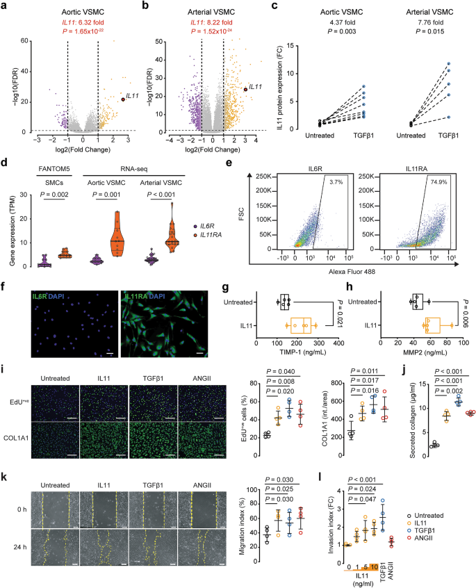 Interleukin-11 is important for vascular smooth muscle phenotypic switching  and aortic inflammation, fibrosis and remodeling in mouse models |  Scientific Reports