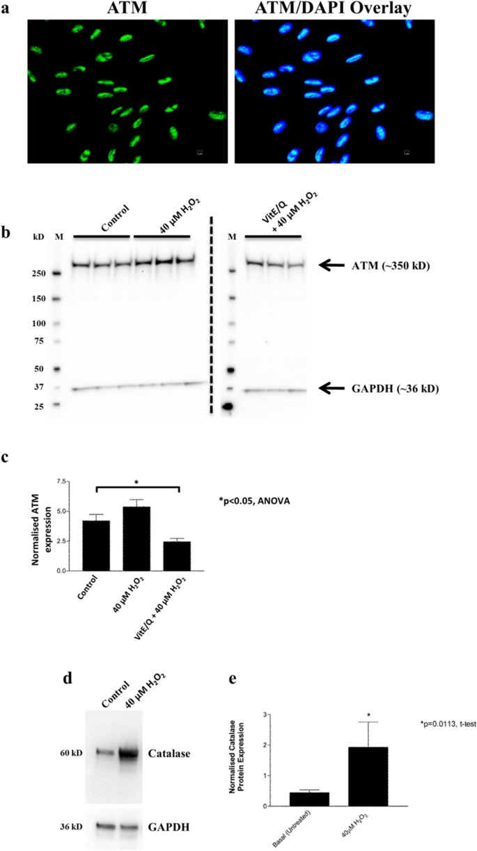 glutathione grey hair study Stress-sensing in the human greying hair follicle: Ataxia Telangiectasia  Mutated (ATM) depletion in hair bulb melanocytes in canities-prone scalp