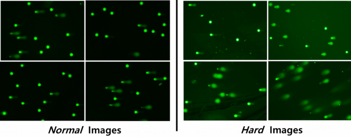 Deep learning method for comet segmentation and comet assay image analysis | Scientific Reports Deep learning method for comet segmentation and comet assay image analysis | Scientific Reports