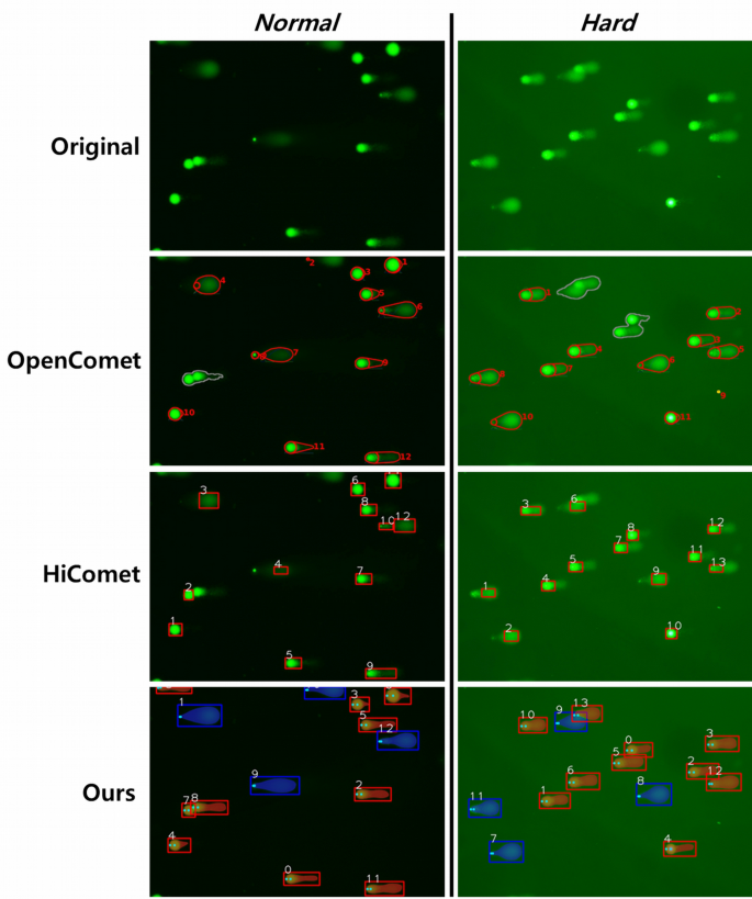 Deep learning method for comet segmentation and comet assay image analysis | Scientific Reports Deep learning method for comet segmentation and comet assay image analysis | Scientific Reports