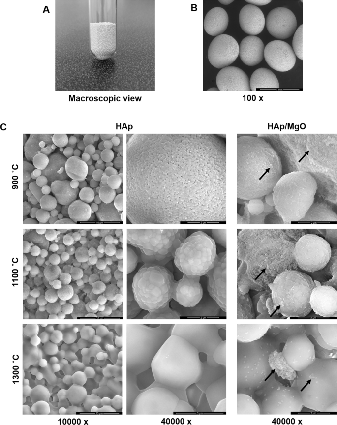 The antibacterial and angiogenic effect of magnesium oxide in a  hydroxyapatite bone substitute | Scientific Reports