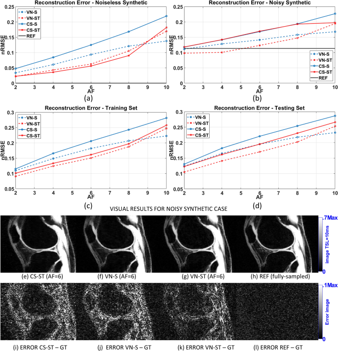 Rapid Mono And Biexponential 3d T 1r Mapping Of Knee Cartilage Using Variational Networks Scientific Reports