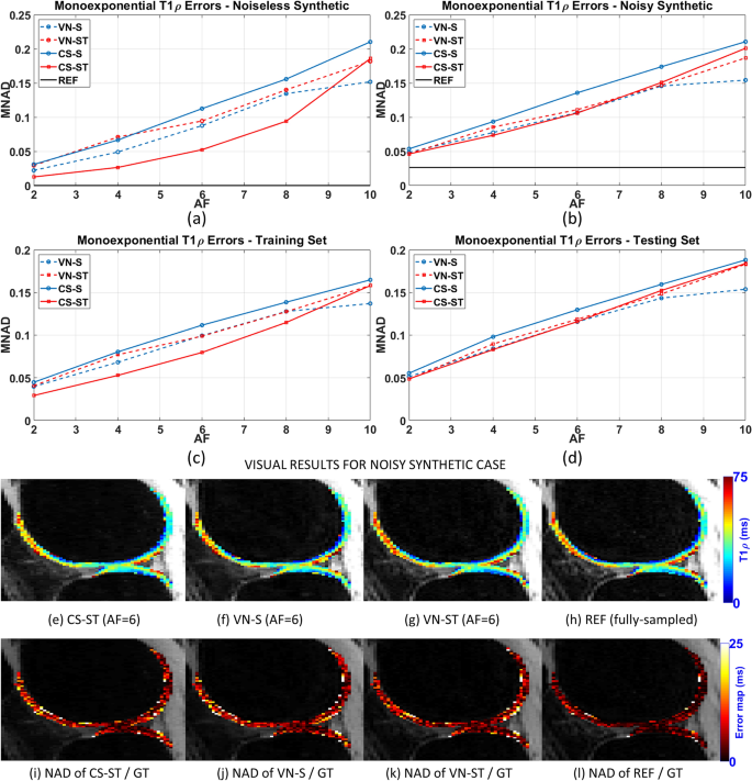 Rapid Mono And Biexponential 3d T 1r Mapping Of Knee Cartilage Using Variational Networks Scientific Reports