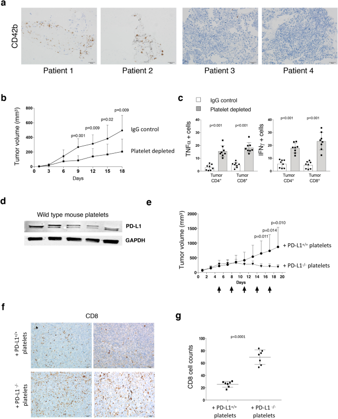 Platelet Pd L1 Suppresses Anti Cancer Immune Cell Activity In Pd L1 Negative Tumors Scientific Reports