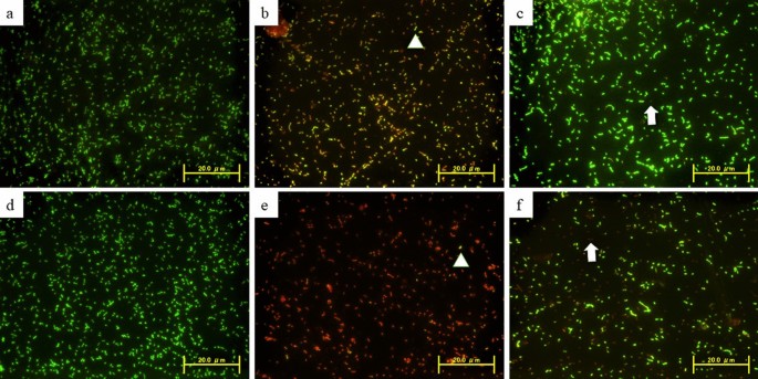 Effects Of Mechanical Abrasion Challenge On Sound And Demineralized Dentin Surfaces Treated With Sdf Scientific Reports Effects Of Mechanical Abrasion Challenge On Sound And Demineralized Dentin Surfaces Treated With Sdf Scientific Reports