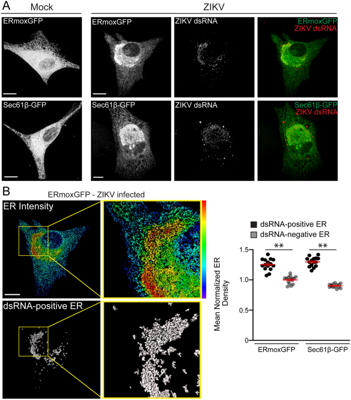 Super Resolution Microscopy And Deep Learning Identify Zika Virus Reorganization Of The Endoplasmic Reticulum Scientific Reports