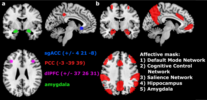 The Relationship Between Resting State Functional Connectivity Antidepressant Discontinuation And Depression Relapse Scientific Reports