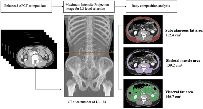 Full Body CT Scans Las Vegas - PDC