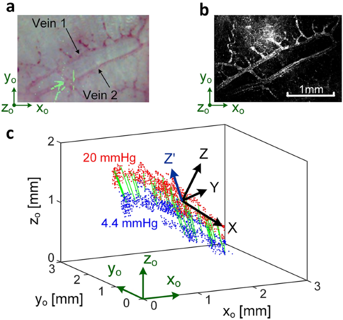 Method for the biomechanical analysis of aqueous veins and perilimbal  sclera by three-dimensional photoacoustic imaging and strain field  calculation | Scientific Reports