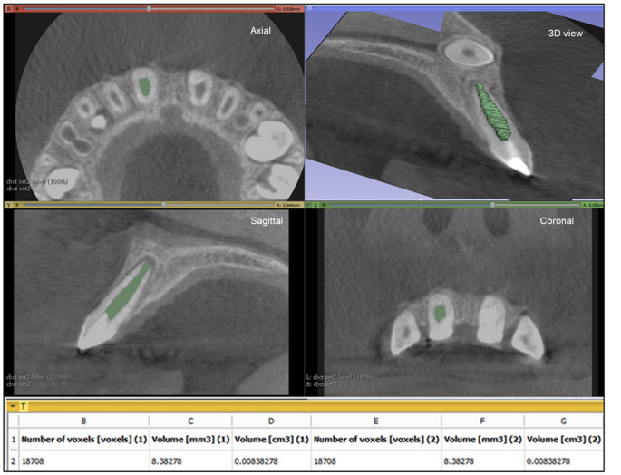 figure4