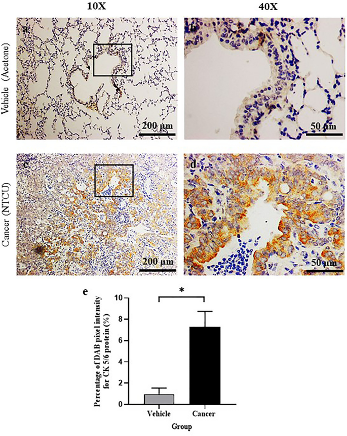 Ntcu Induced Pre Malignant And Malignant Stages Of Lung Squamous Cell Carcinoma In Mice Model Scientific Reports