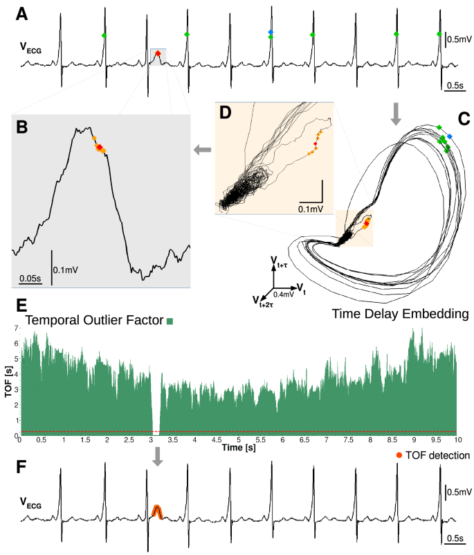 Model-free detection of unique events in time series | Reports