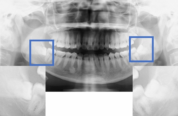 figure2