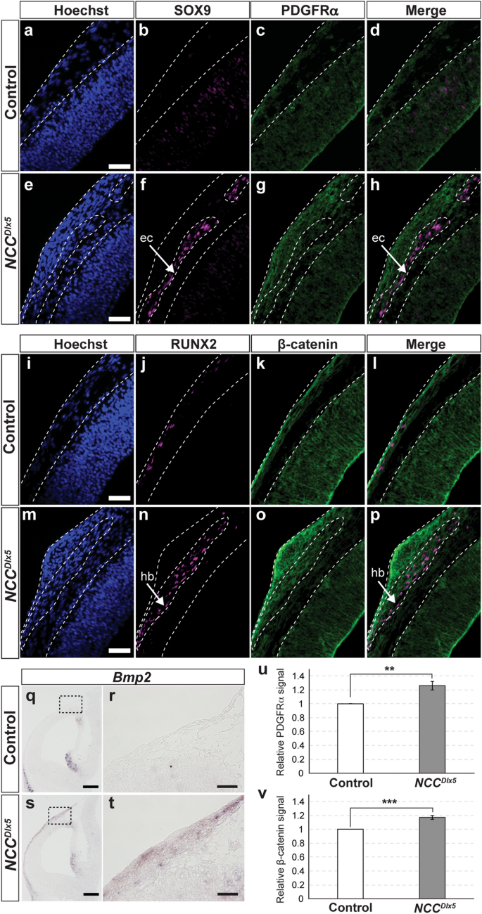 Dlx5 Augmentation In Neural Crest Cells Reveals Early Development And Differentiation Potential Of Mouse Apical Head Mesenchyme Scientific Reports Dlx5 Augmentation In Neural Crest Cells Reveals Early Development And Differentiation Potential Of Mouse Apical Head Mesenchyme Scientific Reports