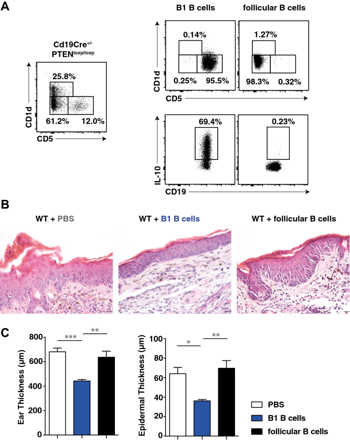 Suppression Of Il 23 Mediated Psoriasis Like Inflammation By Regulatory B Cells Scientific Reports Suppression Of Il 23 Mediated Psoriasis Like Inflammation By Regulatory B Cells Scientific Reports