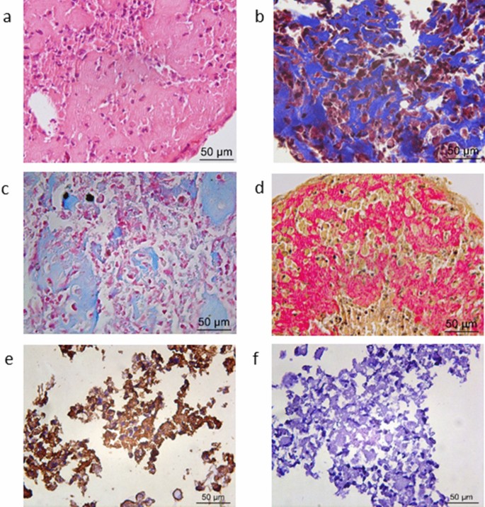Chondrogenesis Of Human Amniotic Fluid Stem Cells In Chitosan Xanthan Scaffold For Cartilage Tissue Engineering Scientific Reports