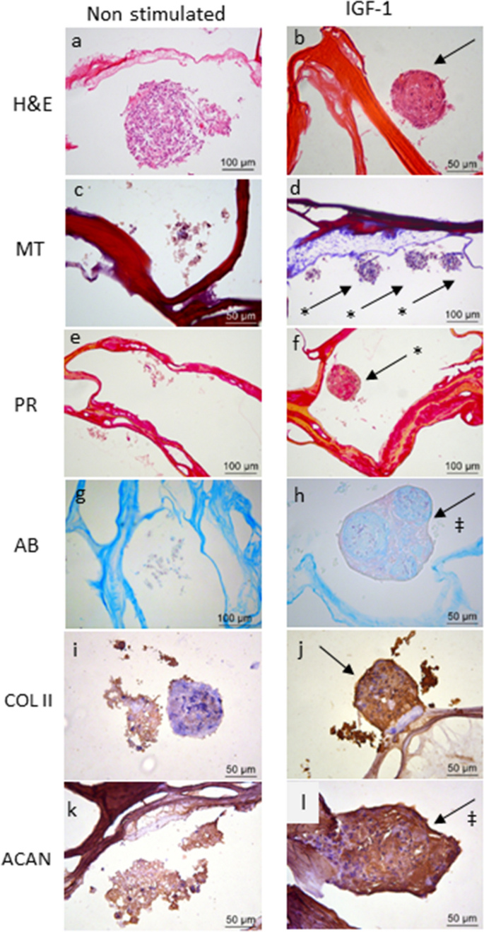 Chondrogenesis Of Human Amniotic Fluid Stem Cells In Chitosan Xanthan Scaffold For Cartilage Tissue Engineering Scientific Reports