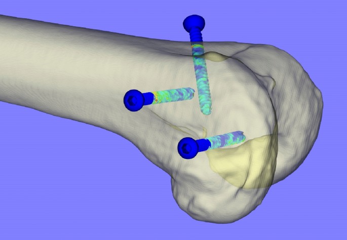 figure3
