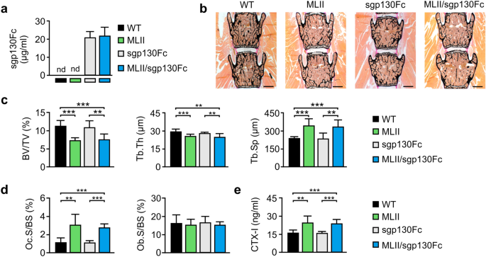 Transgenic Inhibition Of Interleukin 6 Trans Signaling Does Not Prevent Skeletal Pathologies In Mucolipidosis Type Ii Mice Scientific Reports