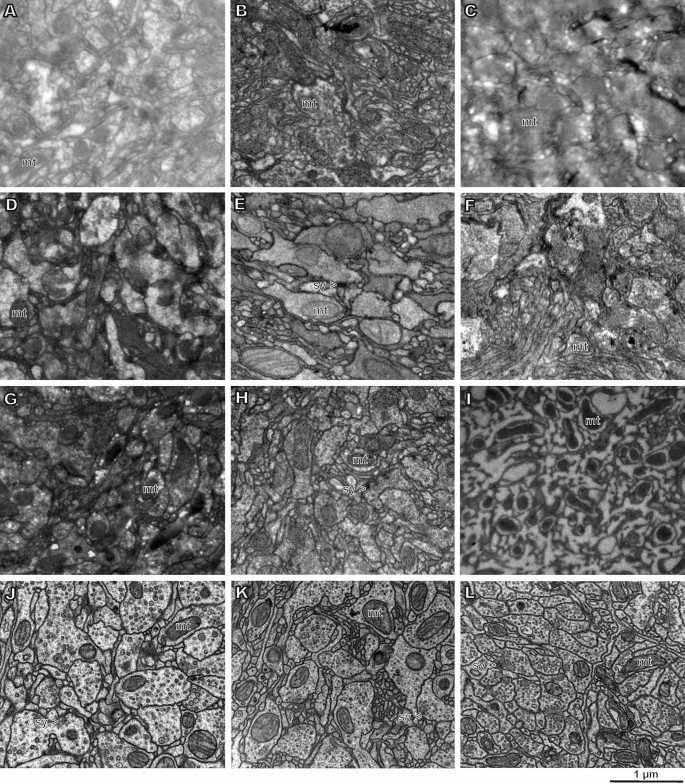 Protocol for preparation of heterogeneous biological samples for 3D  electron microscopy: a case study for insects | Scientific Reports