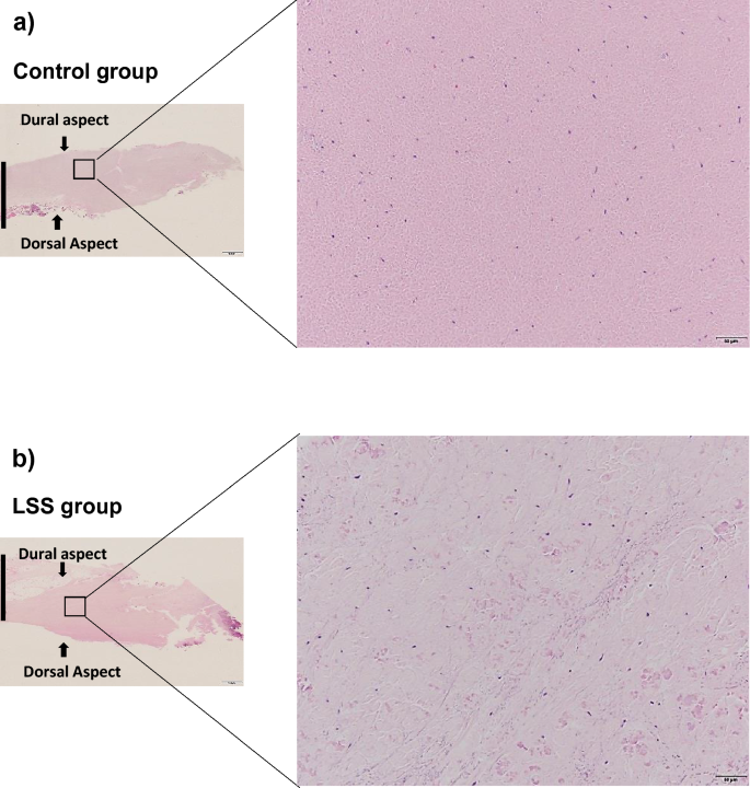 Biglycan Expression And Its Function In Human Ligamentum Flavum Scientific Reports