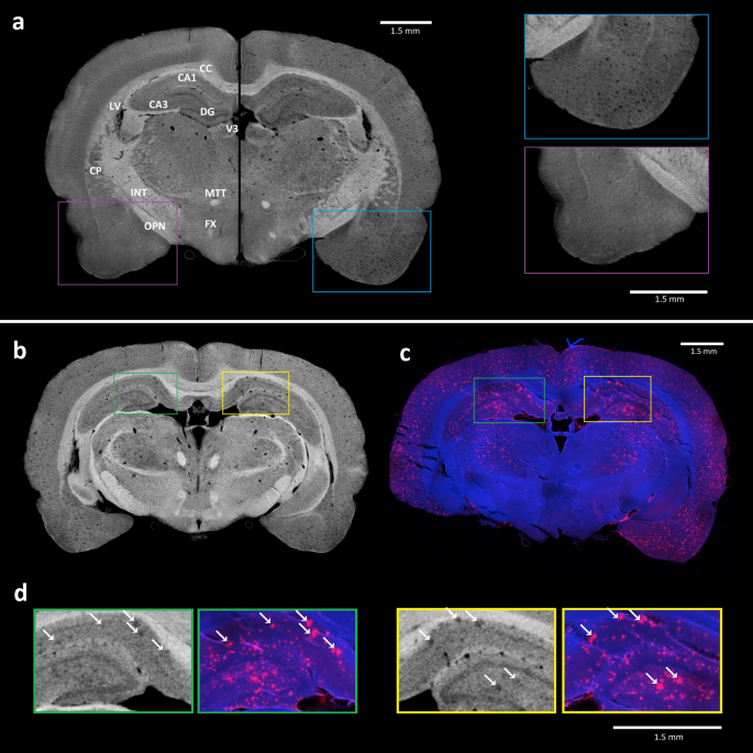 Contrast‐enhanced micro‐computed tomography of compartment and