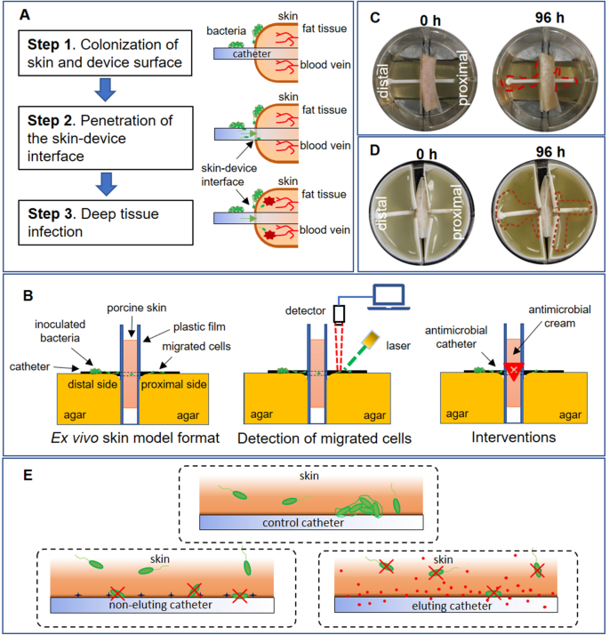 An Ex Vivo Model Of Medical Device Mediated Bacterial Skin Translocation Scientific Reports