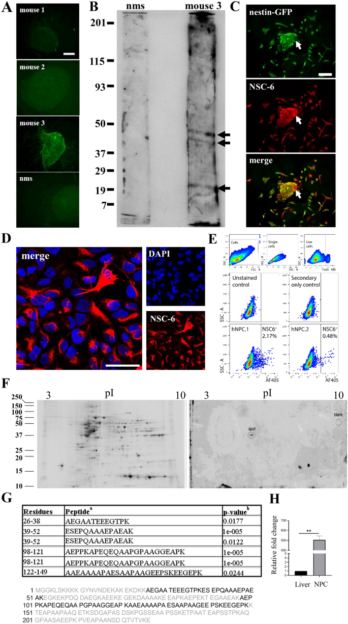 Basp1 Labels Neural Stem Cells In The Neurogenic Niches Of Mammalian Brain Scientific Reports Basp1 Labels Neural Stem Cells In The Neurogenic Niches Of Mammalian Brain Scientific Reports
