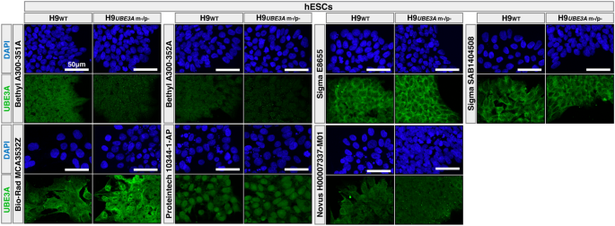 Evaluation of UBE3A antibodies in mice and human cerebral organoids