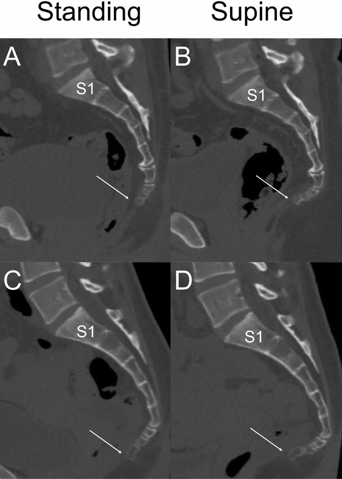 3 Ways Upright Cardiac Imaging Is Different From Supine