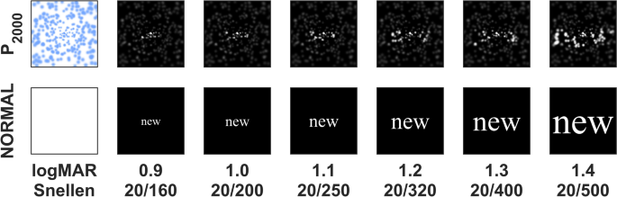 Full Gaze Contingency Provides Better Reading Performance Than Head Steering Alone In A Simulation Of Prosthetic Vision Scientific Reports