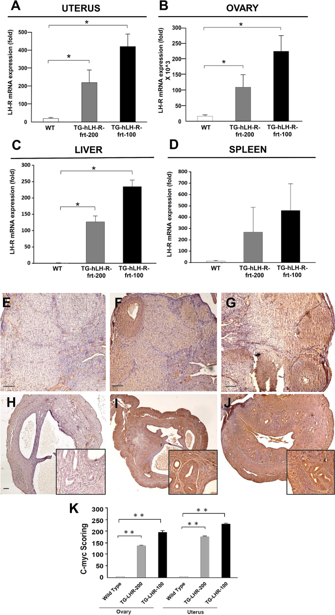Transgenic Mice Overexpressing The Lh Receptor In The Female Reproductive System Spontaneously Develop Endometrial Tumour Masses Scientific Reports