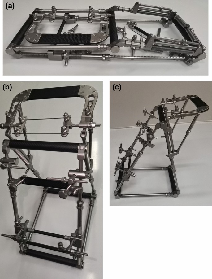 Application of the multiplanar fracture redactor in the treatment of tibial  shaft fractures with intramedullary nails | Scientific Reports