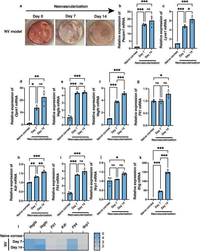 Topical administration of the kappa opioid receptor agonist nalfurafine  suppresses corneal neovascularization and inflammation | Scientific Reports