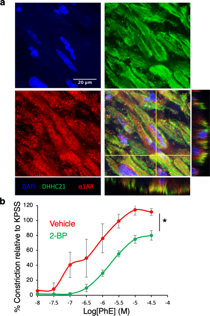 DHHC21 deficiency attenuates renal dysfunction during septic injury |  Scientific Reports