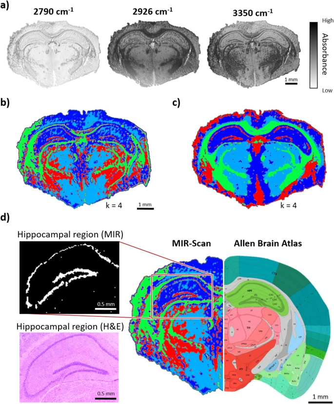 Figure from Kümmel et al. 2021