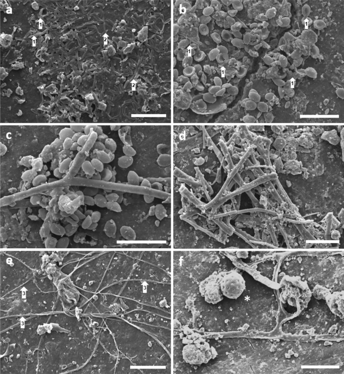 Microplastics accumulate fungal pathogens in terrestrial ecosystems |  Scientific Reports