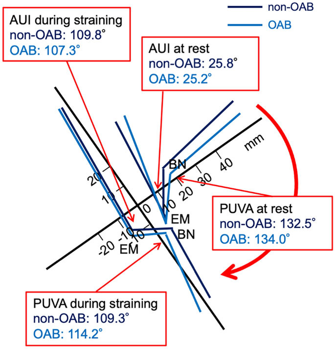 Association Between Overactive Bladder And Pelvic Organ Mobility As Evaluated By Dynamic Magnetic Resonance Imaging Scientific Reports